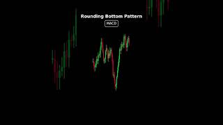 Rounding Bottom Technical Analysis