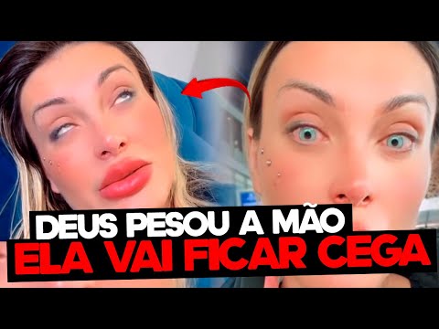 Andressa Urach Pode Ficar Cega Depois Que trocou a cor dos olhos, Deus Pesou a Sua Mão?