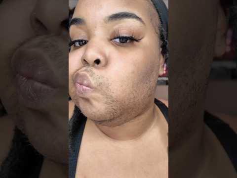 4.19.24 face wax w/ @tresswellness 🩷 #pcos #hirsutism #facewax #hardwax #daquanawhite