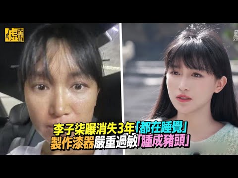 李子柒曝消失3年「都在睡覺」 接觸生漆嚴重過敏「腫成豬頭」