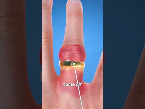 How to remove ring from finger in Roblox Brookhaven