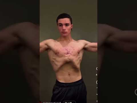 Stay Natty! side effects of steroids