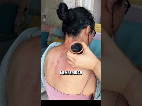 Terapi Tradisional Ini Katanya Bisa Redakan Nyeri! #halmenarik