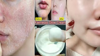 दुनिया की सबसे अच्छी Winter Glow क्रीम जो Dry स्किन को बच्चों जैसी मुलायम Soft Glowing बनाएगी