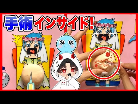 インサイドヘッドのキャラクターのおなかを開いて手術した結果がヤバすぎる・・・😱【インサイド・ヘッド2 / Inside Out 2 】