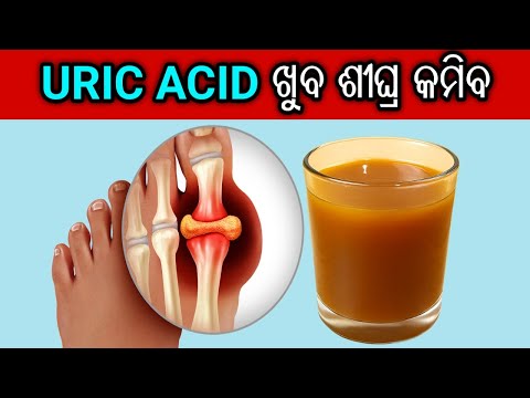 ପ୍ରତିଦିନ ୧ ଗ୍ଲାସ ପିଅନ୍ତୁ, URIC ACID କେବେବି ବଢିବ ନାହିଁ | Home Remedy for Uric Acid in Odia