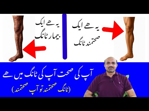 Never Compromise on Your Legs’ Health | How to Keep Legs Strong, Pain-Free & Active?