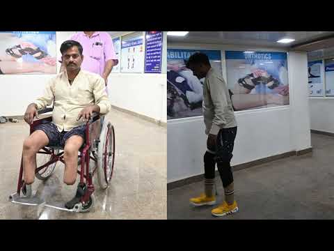 Artificial Limbs Moving by his own