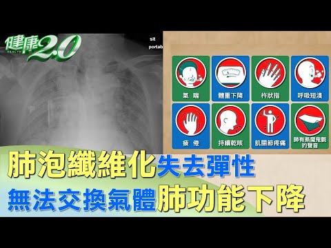 肺泡纖維化失去彈性 無法交換氣體肺功能下降 健康2.0