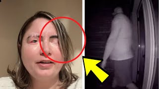 When Woman Looked At Her Face In The Morning, She Was Shocked To See What Her Husband Did To Her