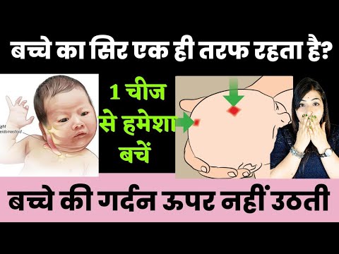 बच्चे की गर्दन हिलती रहती है ऊपर नहीं उठती क्यों?Baby development