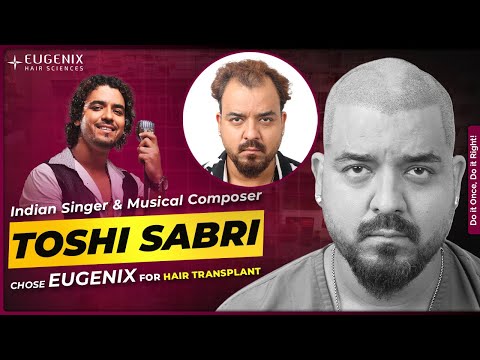 Toshi Sabri Hair Transplant at Eugenix Hair Sciences | Bollywood Singer’s Hair Restoration