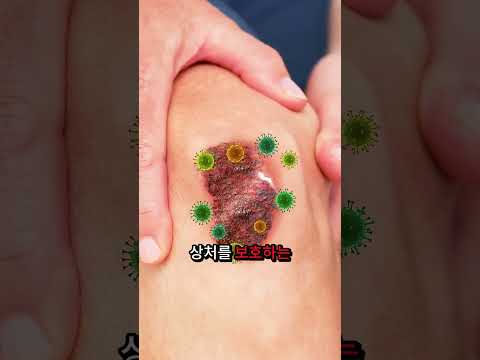 딱지가 생기면 떼고 싶은 유혹에 빠지지 마세요