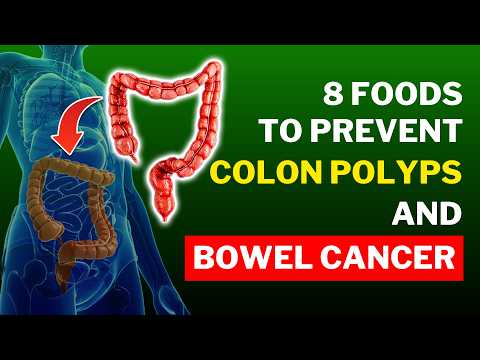 Top Foods to STOP Colon Polyps Naturally