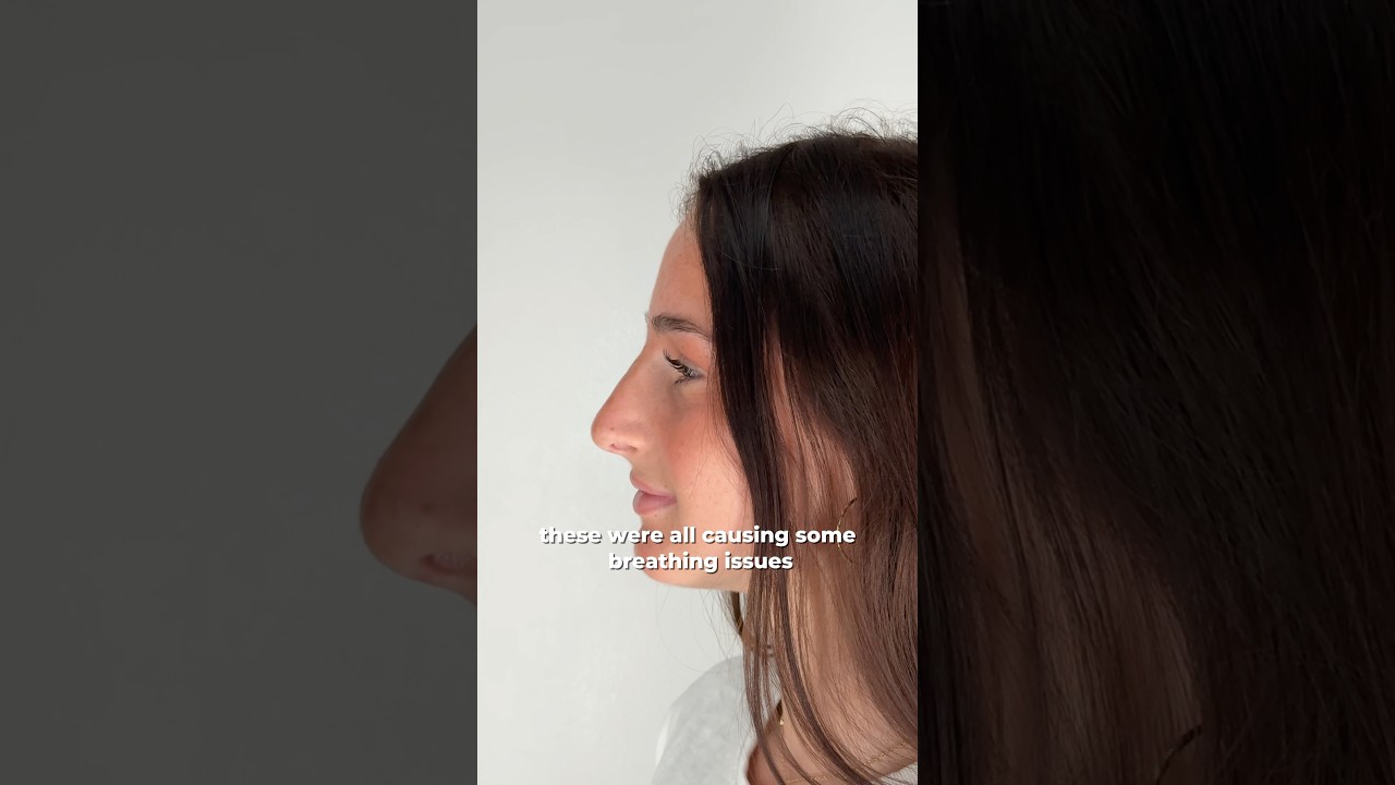 Profile view of woman discussing breathing issues.