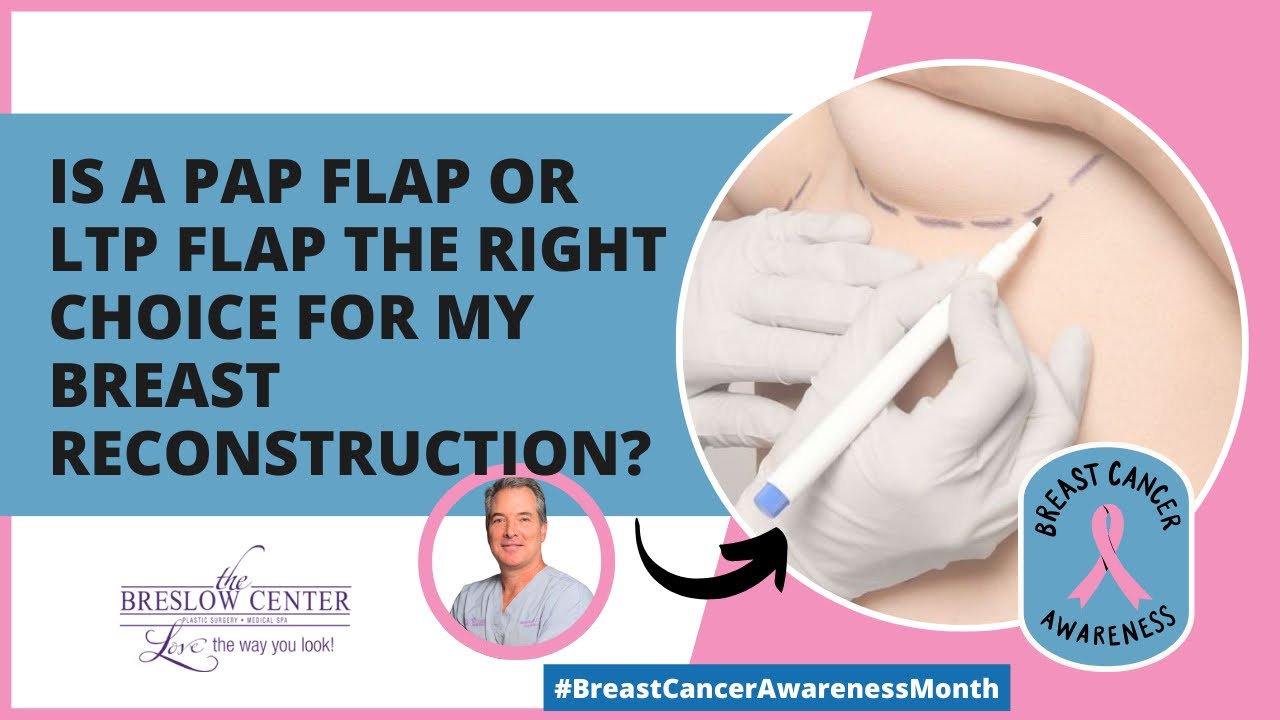 Breast reconstruction flap options discussion.
