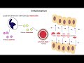 Immune Response and Inflammation Concepts