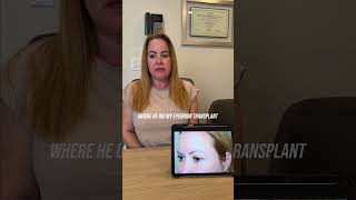 Eyebrow transplant patient shares her testimonial | J. Epstein MD, FACS | Miami, FL
