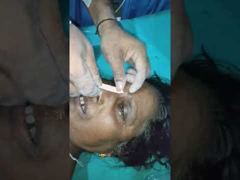 How insert rt tube when nose block #Creativeshortsatoz