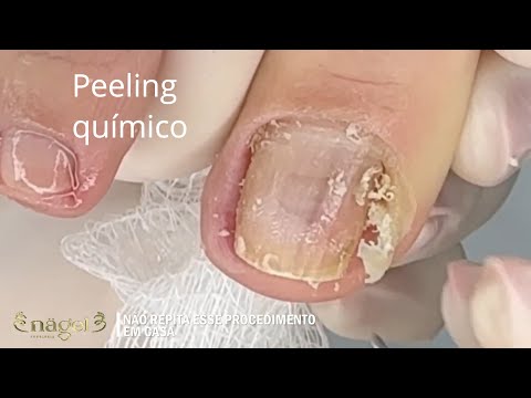 Você não vai acreditar o que aconteceu ali! #satisfying #nails