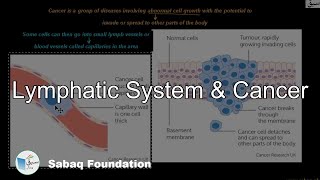 Lymphatic System & Cancer