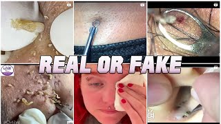 Blackheads and Growths!  Real or Fake?
