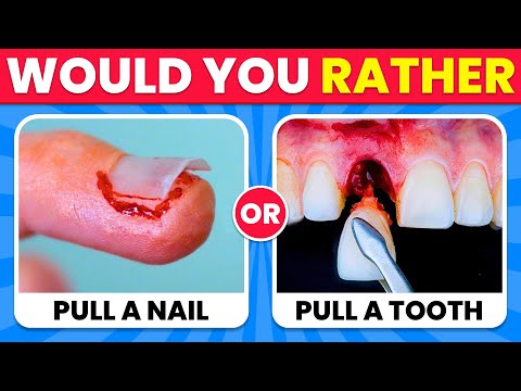 Would You Rather...? 100 HARDEST Choices Ever! 😱😨