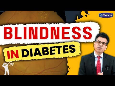 Blindness In Diabetes | Retinopathy In Diabetes | Diabexy