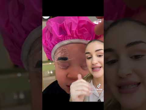 Commento la trasformazione di una bambina ALBINA