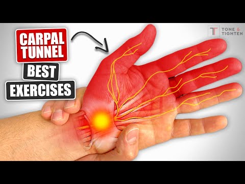 Carpal Tunnel Syndrome Exercises [Can Help AVOID Carpal Tunnel Surgery!]