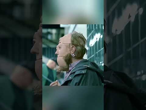 Der Kopf eines Mannes verwandelte sich nach einer Operation in einen Zauberwürfel.