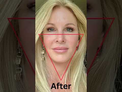 Dr. Amir Karam's Vertical Restore Facelift is the KEY to a YOUTHFUL APPEARANCE!