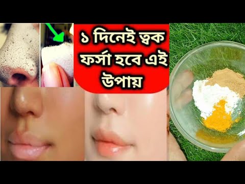 একদিনেই চেহারা ফর্সা হবে, মুখের কালো ময়লা ও নাকের ব্ল্যাকহেডস তুলে দেবে// ফর্সা হওয়ার সহজ উপায়