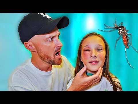 OLIVIA has an ALLERGIC REACTION on her FACE to BUG BITES!