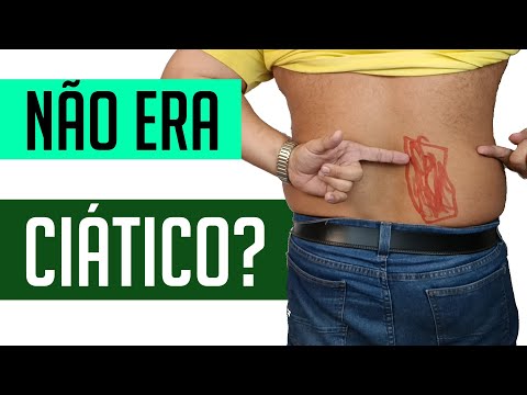 ENGANA MUITA GENTE: CAUSA DE DOR NO GLÚTEO E QUADRIL - QUADRADO LOMBAR
