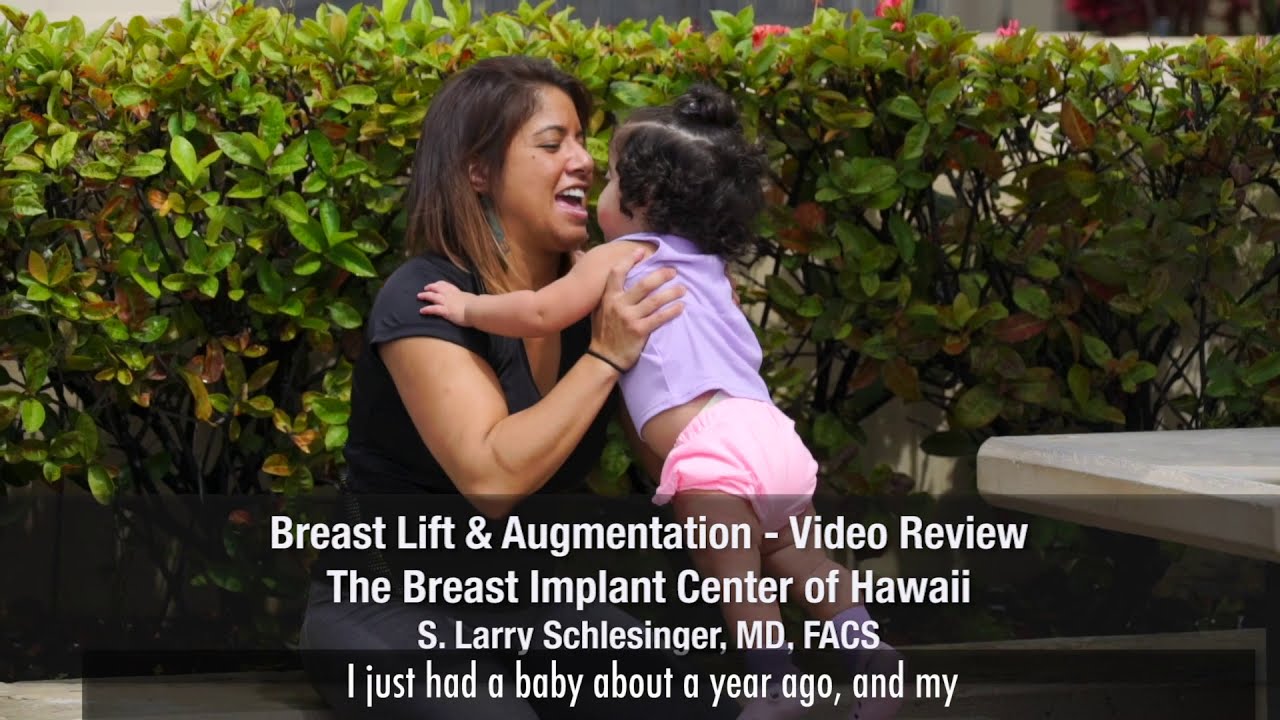 Breast Lift & Breast Implants - Video Review, Honolulu Hawaii - Breast Implant Center of Hawaii