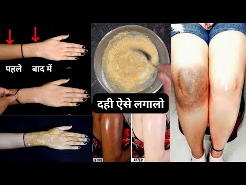 दही में ये मिलालो, 1 से 2 shade अपनी Skin को निखारे, सालो साल जमी मेल/गंदगी निकाले, Skin Brightening