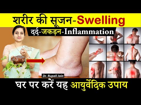 शरीर की सूजन दूर करने के आयुर्वेदिक उपाय || Ayurvedic Treatment of Swelling- Dr. Rupali Jain #health