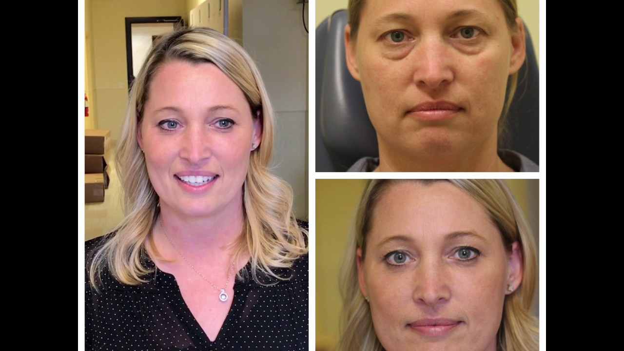 Before and after facial appearance transformation images.