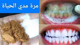 أقسم بالله ‼️لن تحتاج للذهاب لطبيب الأسنان ‼️لتبييض الأسنان واسقاط الجير‼️سيسقط لوحده بدون رجعة