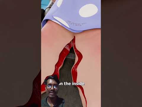 Turning ioose skin lhto a wingsuit😮