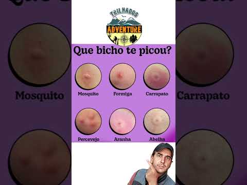 TOMOU UMA PICADA? SAIBA QUAL BICHO PICOU! #dicas #natureza #curiosidades #aventura #trilha