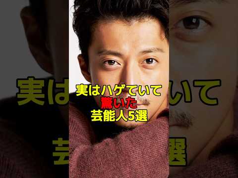 意外とハゲている芸能人5選：驚きの事実とエピソード サムネイル