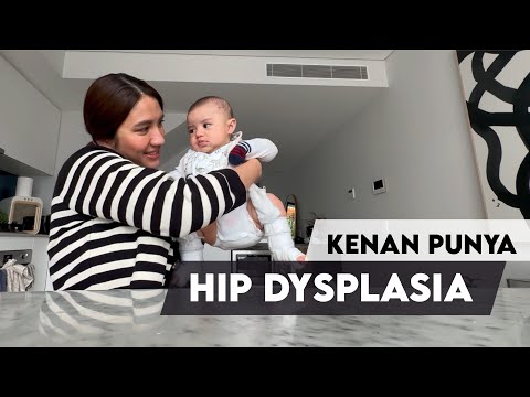 Kenan ternyata punya Hip Displasia.