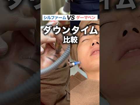 【シルファームvsダーマペン】ダウンタイム比較してみた！　#shorts