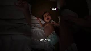 مأساة الصغيرة راسيل والتي تعاني سوء تغذية حاد بغزة