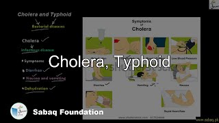 Cholera, Typhoid