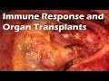 Organ Transplant Immunology Concepts