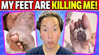 Doctor Reacts to MY FEET ARE KILLING ME! Compilation