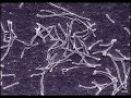 Taq DNA Polymerase and Thermus Aquaticus